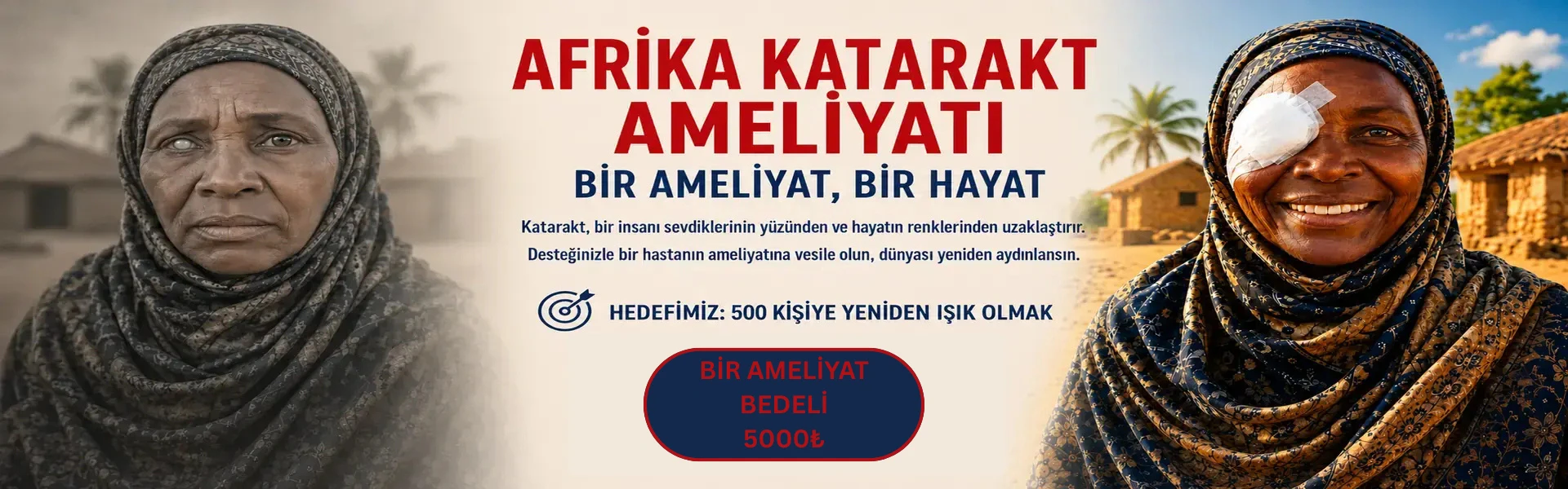 Afrika Katarakt