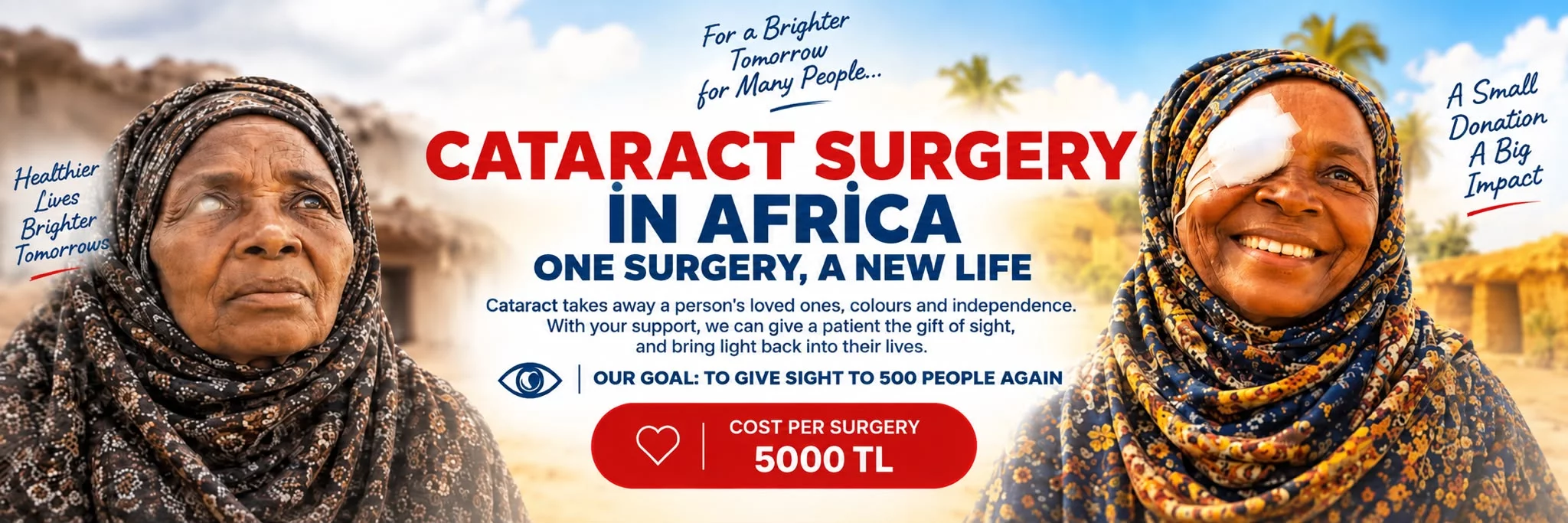 Afrika Katarakt