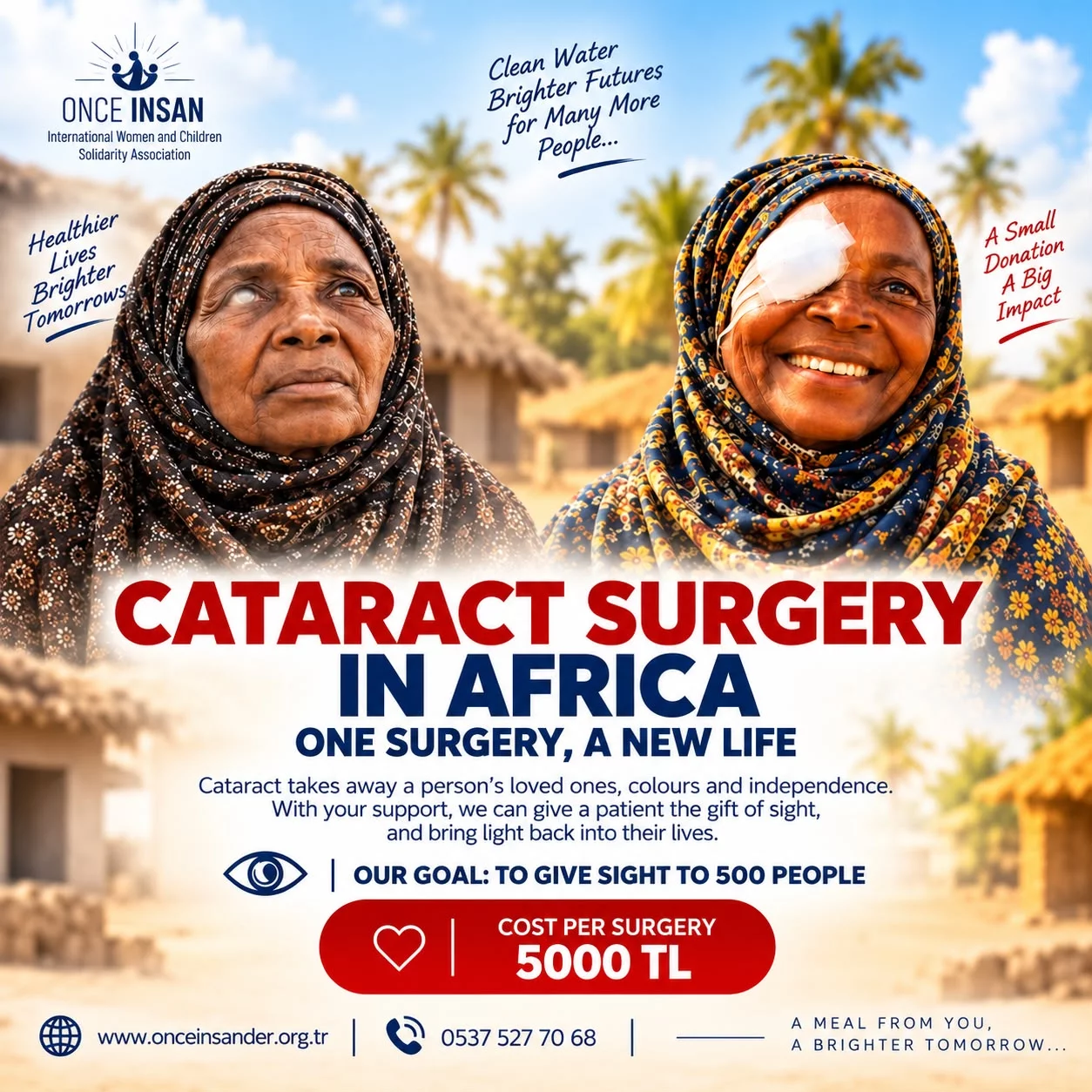 Afrika Katarakt